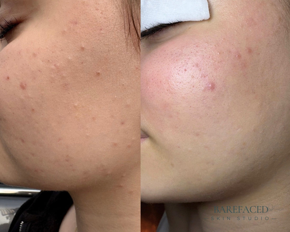 Why Someone Else's Skincare Routine Isn't Working for You