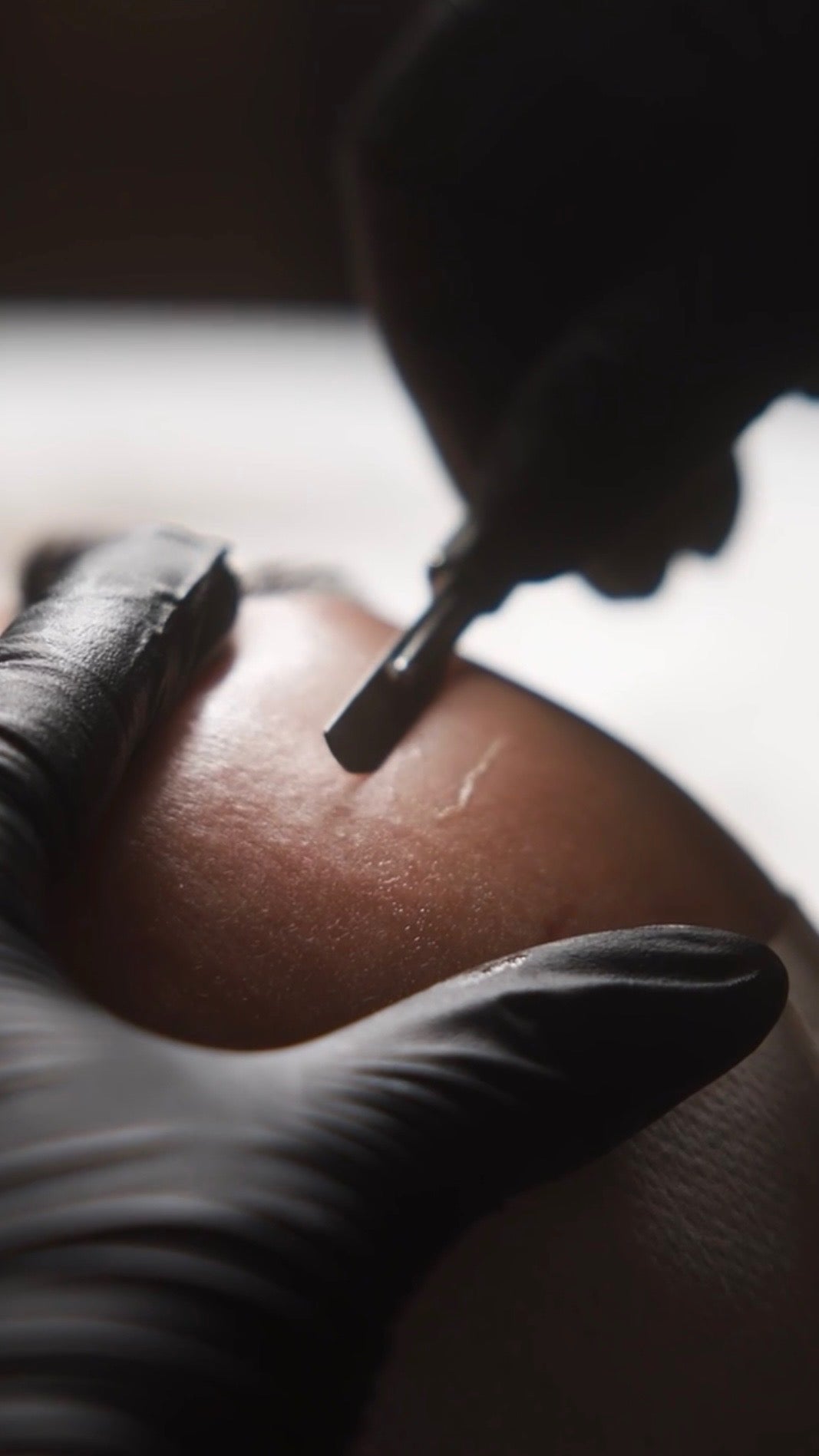 What Is Dermaplaning, How Often Should I Get a Dermaplane Facial, and Can You Dermaplane At Home?